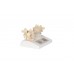 model dydaktyczny osteoporozy - 3b smart anatomy - 1000182 [a95] 3b scientific modele anatomiczne 4